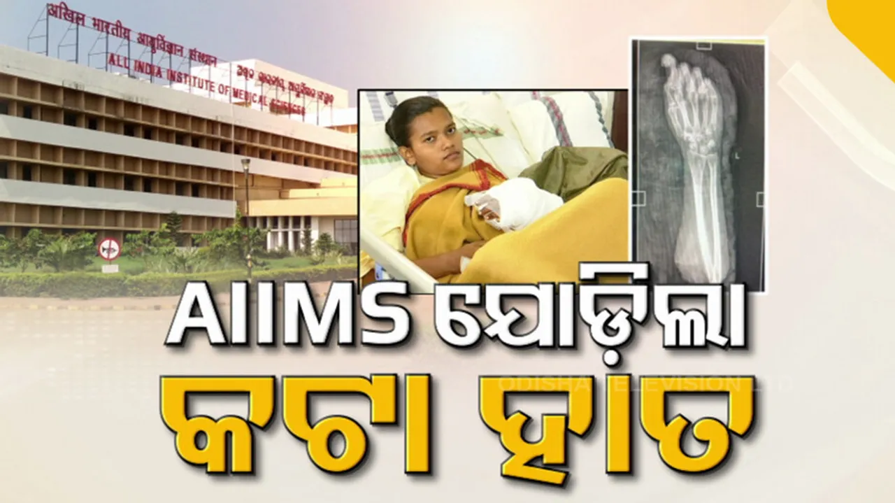 Rare Surgery at AIIMS