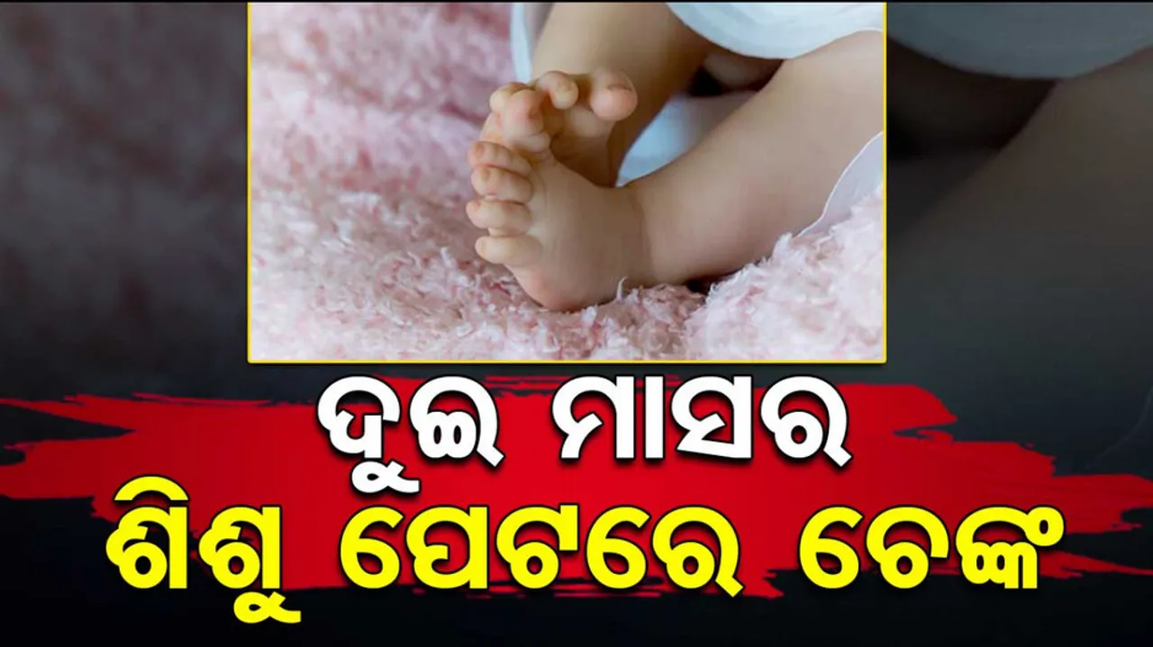 Quack Brands Two Month Old With Hot Iron Rod To Cure Cough