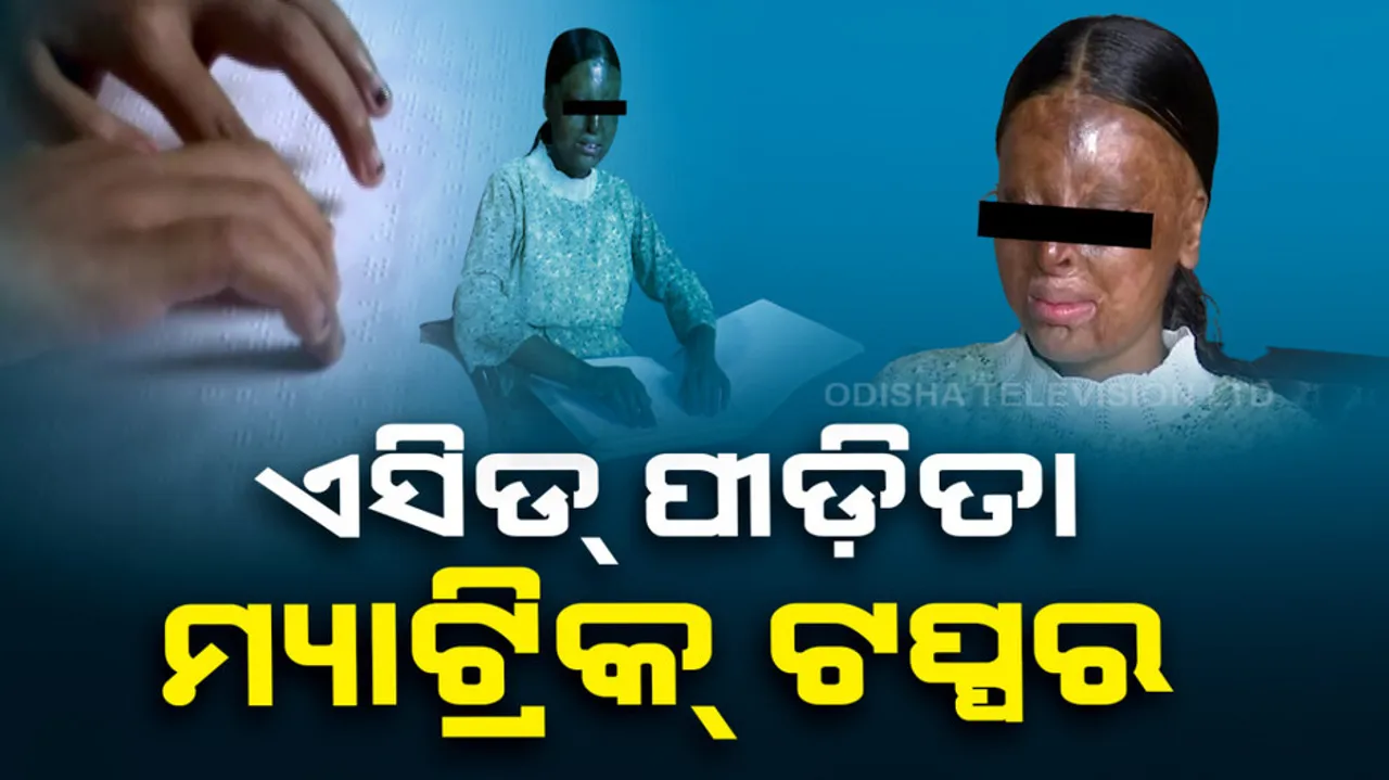 Acid attack survivor 