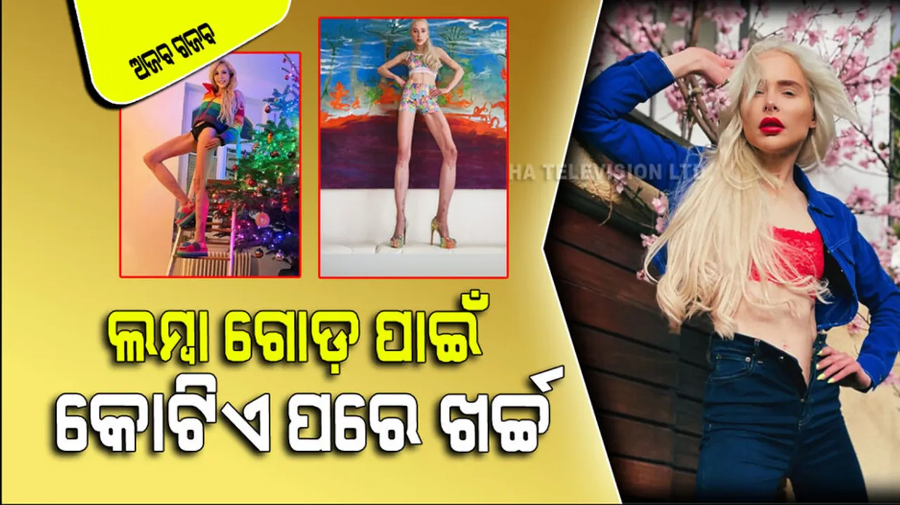 Model spends more than one crore rupees on operations to lengthen her legs