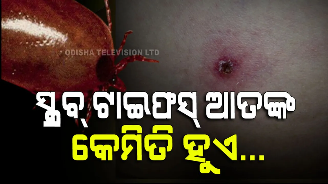 What is Scrub Typhus