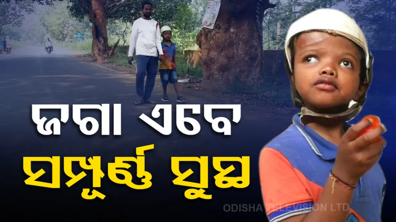 One of Conjoined twins is now completely healthy