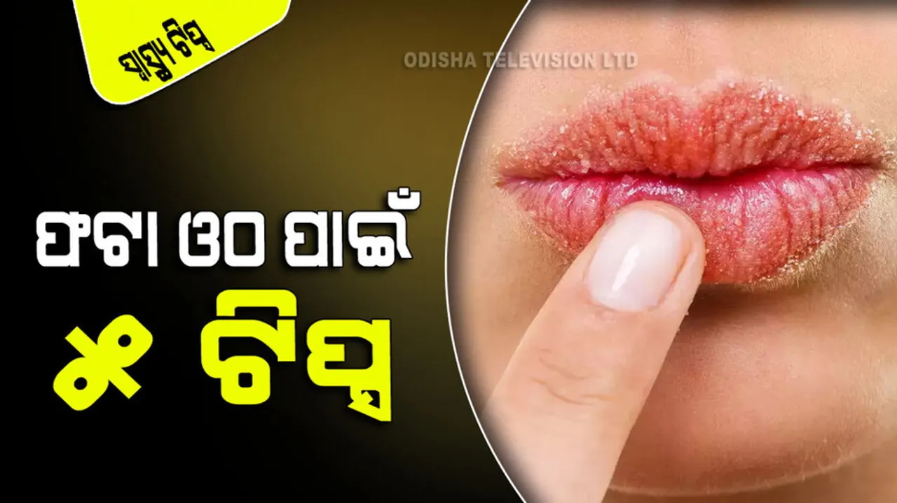 5 home remedies to get rid of chapped lips in winter