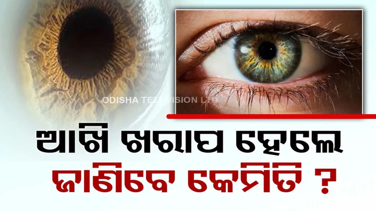 computer vision syndrome