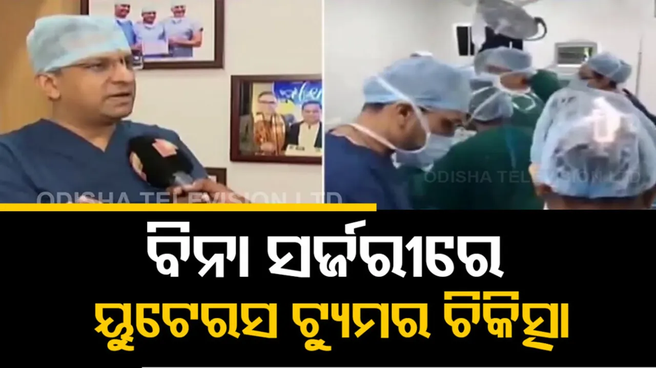 Uterus Tumor Treatment