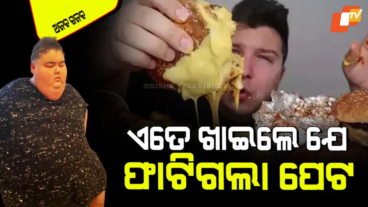 24 year old young man stomach burst due to eating too much