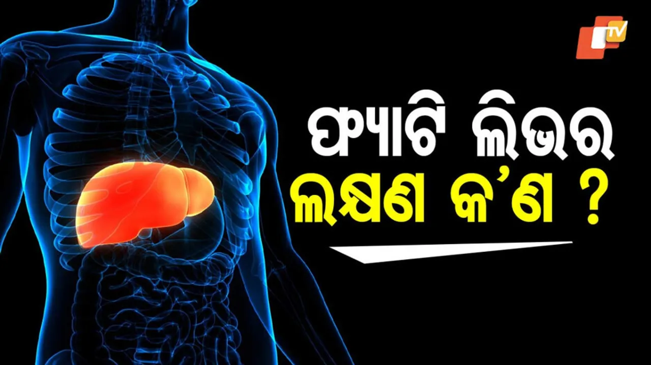 ଫ୍ୟାଟି ଲିଭର ଲକ୍ଷଣ