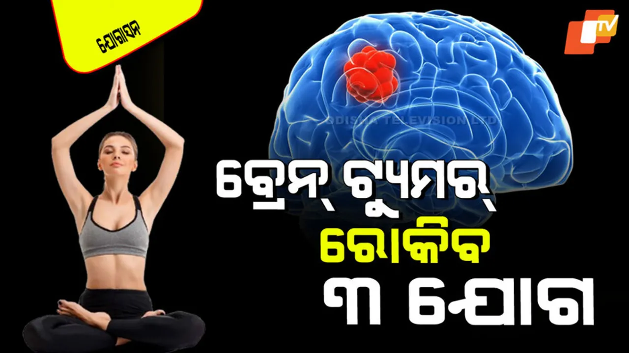 Yoga Asanas that may help reduce brain tumor risk