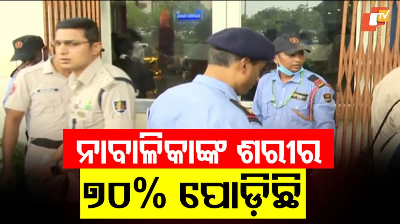 Minor Girl Suffers 70% Burns