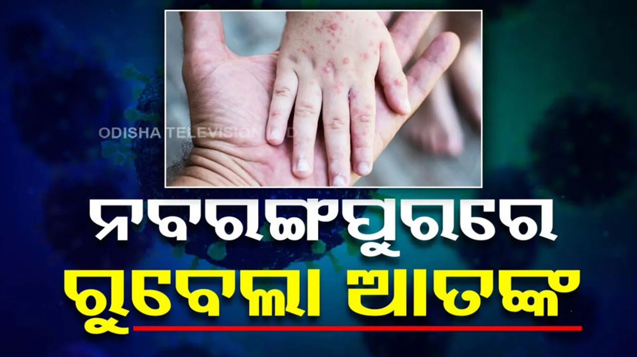 Rubella Cases Detected In Odisha's nabarangpur