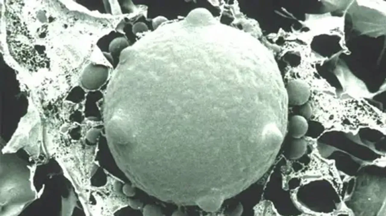 ହ୍ୱାଇଟ୍ ଫଙ୍ଗସ୍ କଣ, ଏହା କାହିଁକି ବ୍ଲାକ୍ ଫଙ୍ଗସ୍ ଠାରୁ ବିପଜ୍ଜନକ? ଜାଣନ୍ତୁ…