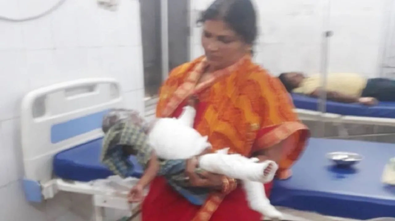 ଆଖି ବୁଜିଲା ପୋଡ଼ିଯାଇଥିବା ଶିଶୁ