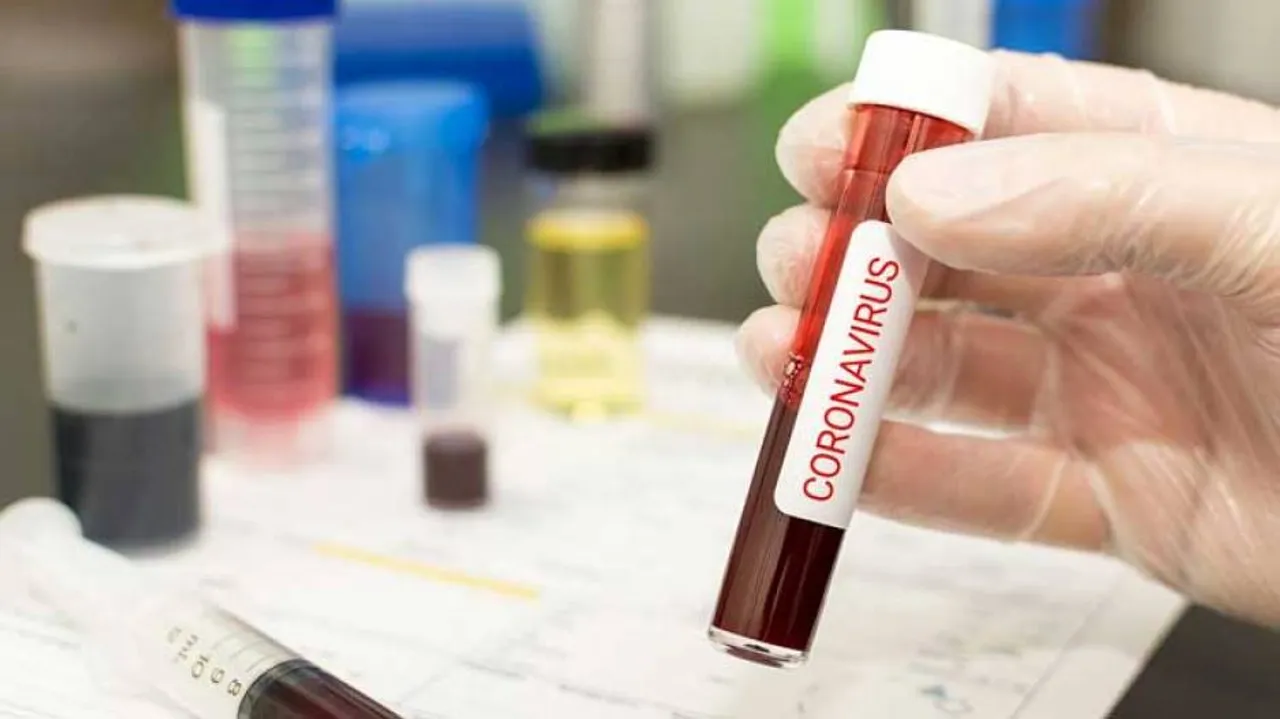 ରାଜ୍ୟର ୧୪ ଜଣ ମନ୍ତ୍ରୀ, ବିଧାୟକ କରୋନା ପଜିଟିଭ ଚିହ୍ନଟ