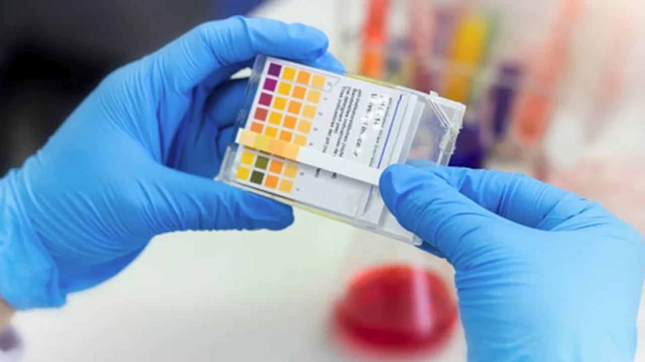 ଏଣିକି ଅଧଘଣ୍ଟାରେ ହେବ କୋଭିଡ୍ ଟେଷ୍ଟ