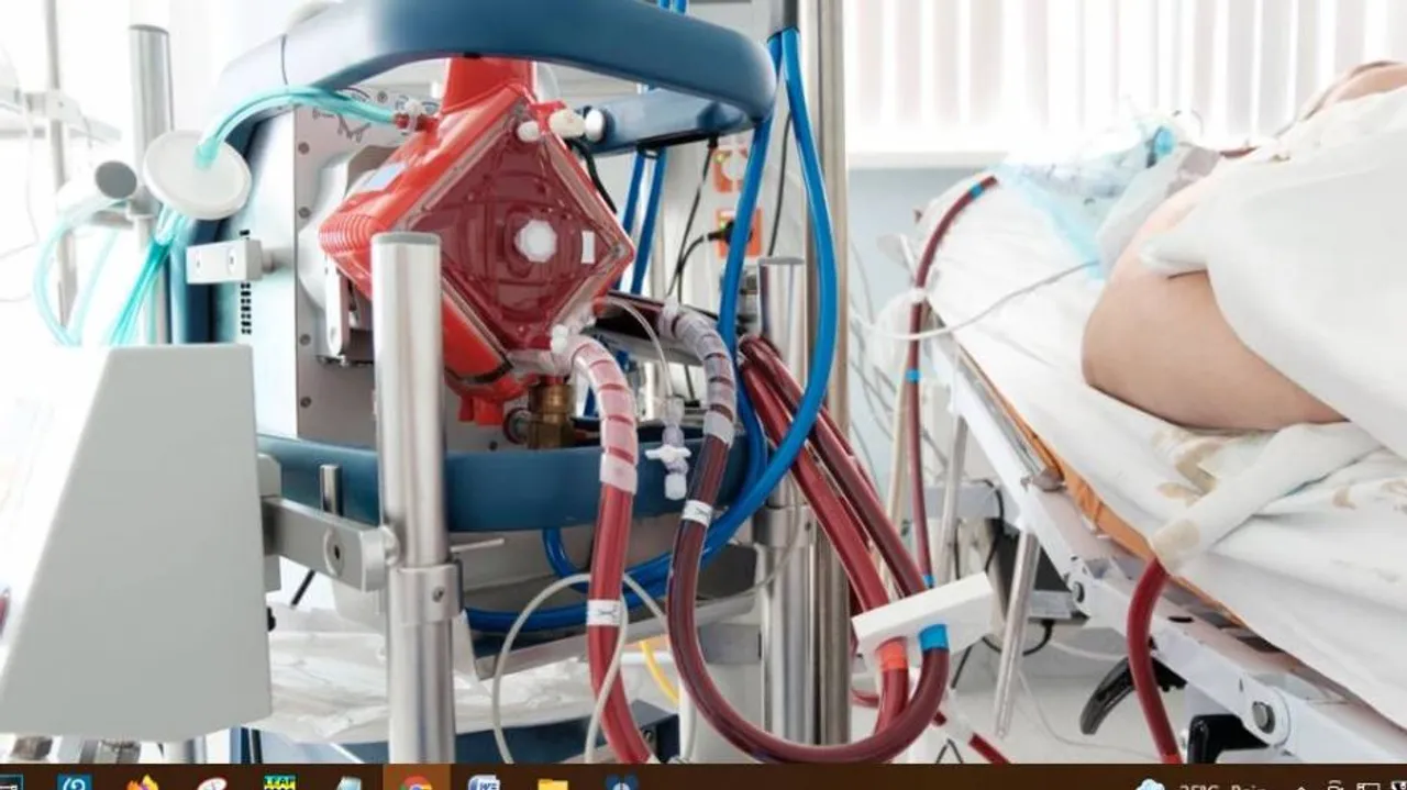 ଗୁରୁତର କୋଭିଡ ରୋଗୀଙ୍କ ପାଇଁ କେତେ ଆବଶ୍ୟକ ଏକ୍‌ମୋ ମେସିନ ?