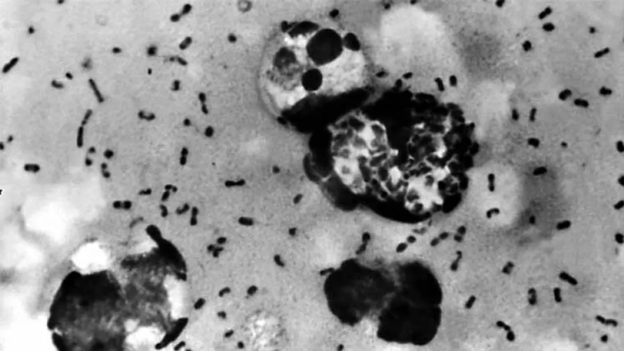 ସତର୍କ ରୁହ ବିଶ୍ୱବାସୀ ! ଆସୁଛି ଆଉ ଏକ ମହାମାରୀ