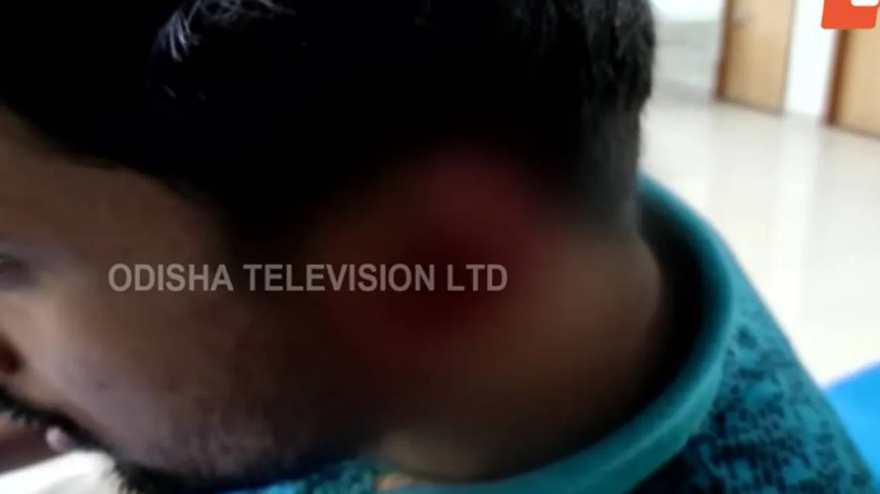 ଡାକ୍ତରଙ୍କ କାନ ଛିଡ଼ାଇ ଦେଲେ ରୋଗୀଙ୍କ ସର୍ମ୍ପକୀୟ