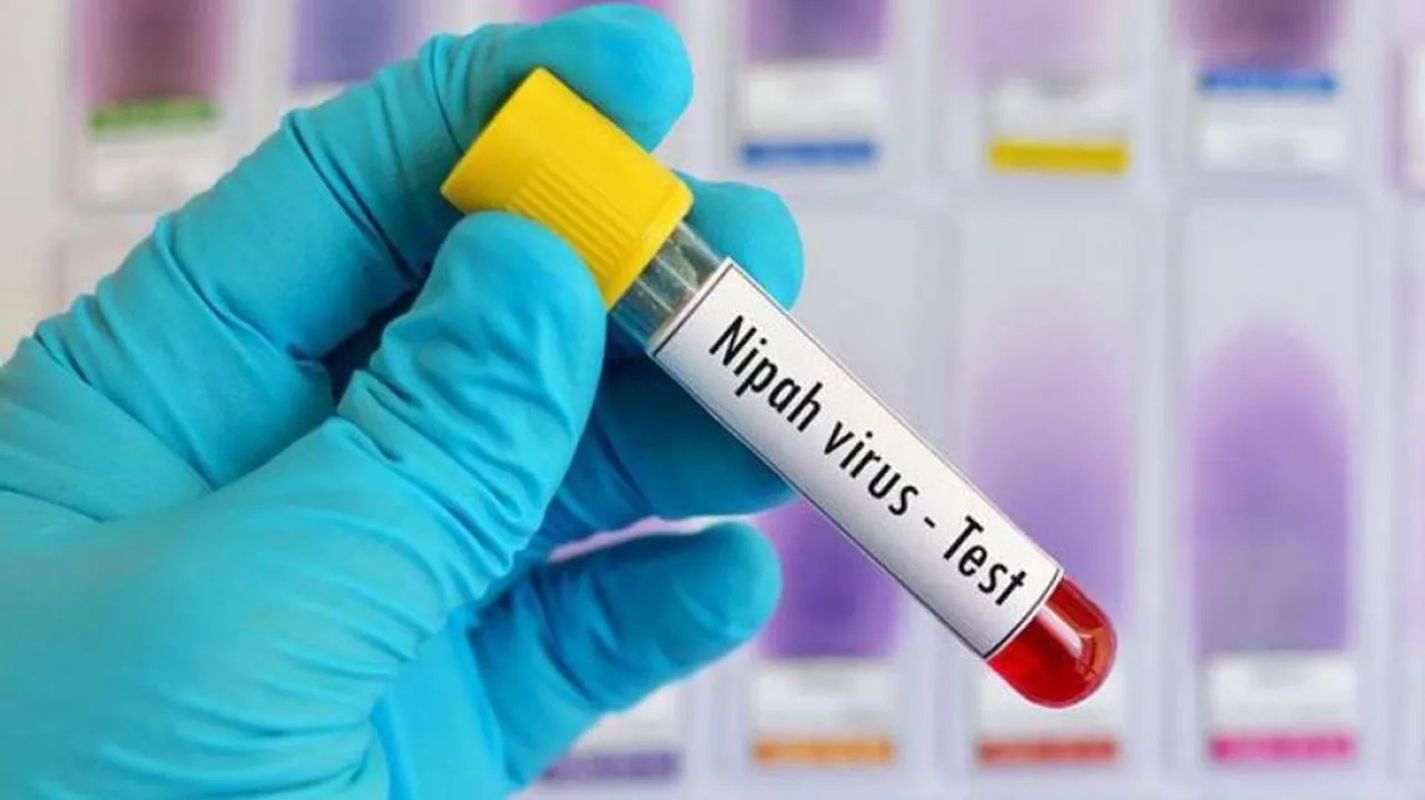 ଏଚ୍‌ଆଇଭି, ଇବୋଲା ପରେ ଆସିଲା ପ୍ରାଣଘାତକ ନିପା ଭୁତାଣୁ