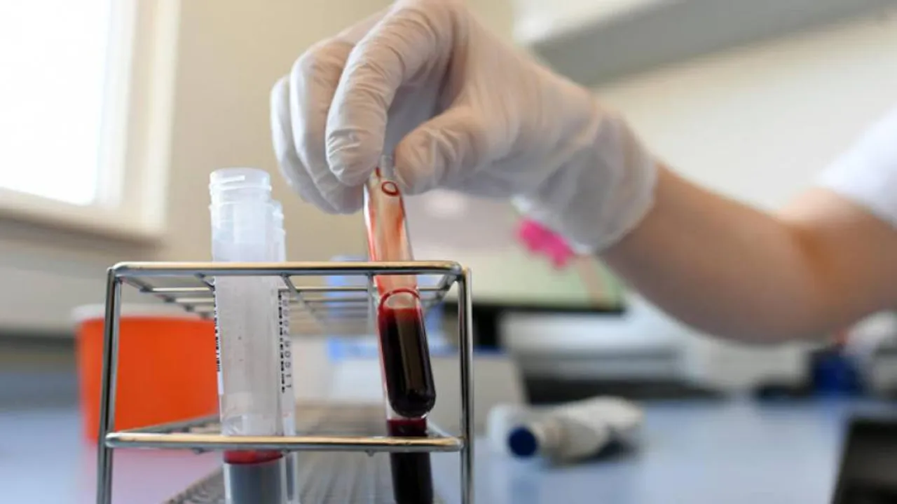 କାମ ଦେଉଛି ପ୍ଲାଜମା, ରାଜ୍ୟର ପ୍ରଥମ ରୋଗୀ ସୁସ୍ଥ