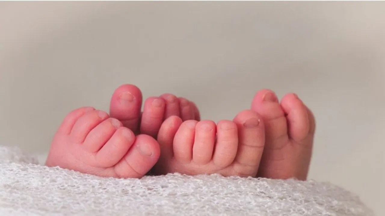 Woman Gives Birth To Conjoined Twins in Sambalpur 