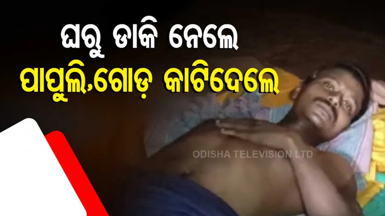 Leg And Palm Of A Migrant Labourer From Gajapati Area Chopped Off 