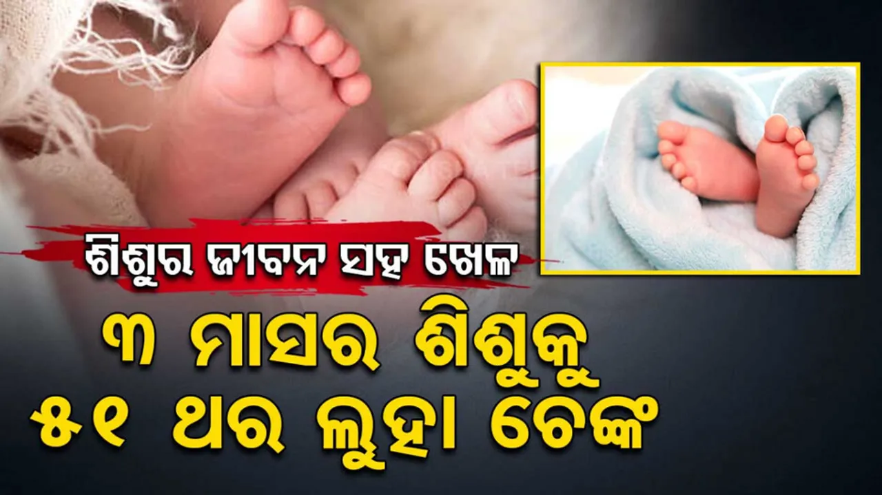 3-Month-Old Baby Poked 51 Times With Hot Rod