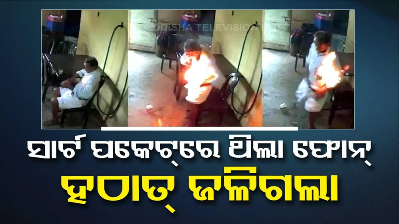 Mobile phone explodes in shirt pocket