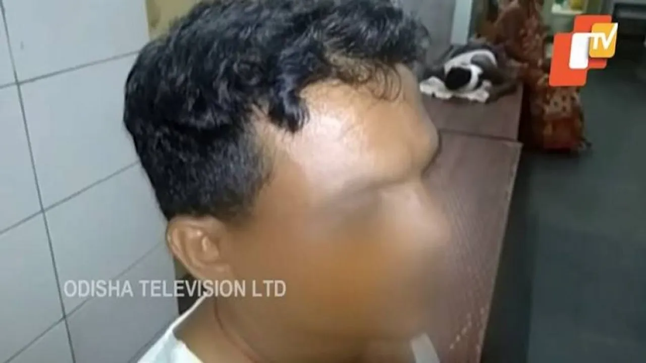 ଏଲ୍‌ଆଇସି ଏଜେଣ୍ଟଙ୍କୁ ମରଣାନ୍ତକ ଆକ୍ରମଣ