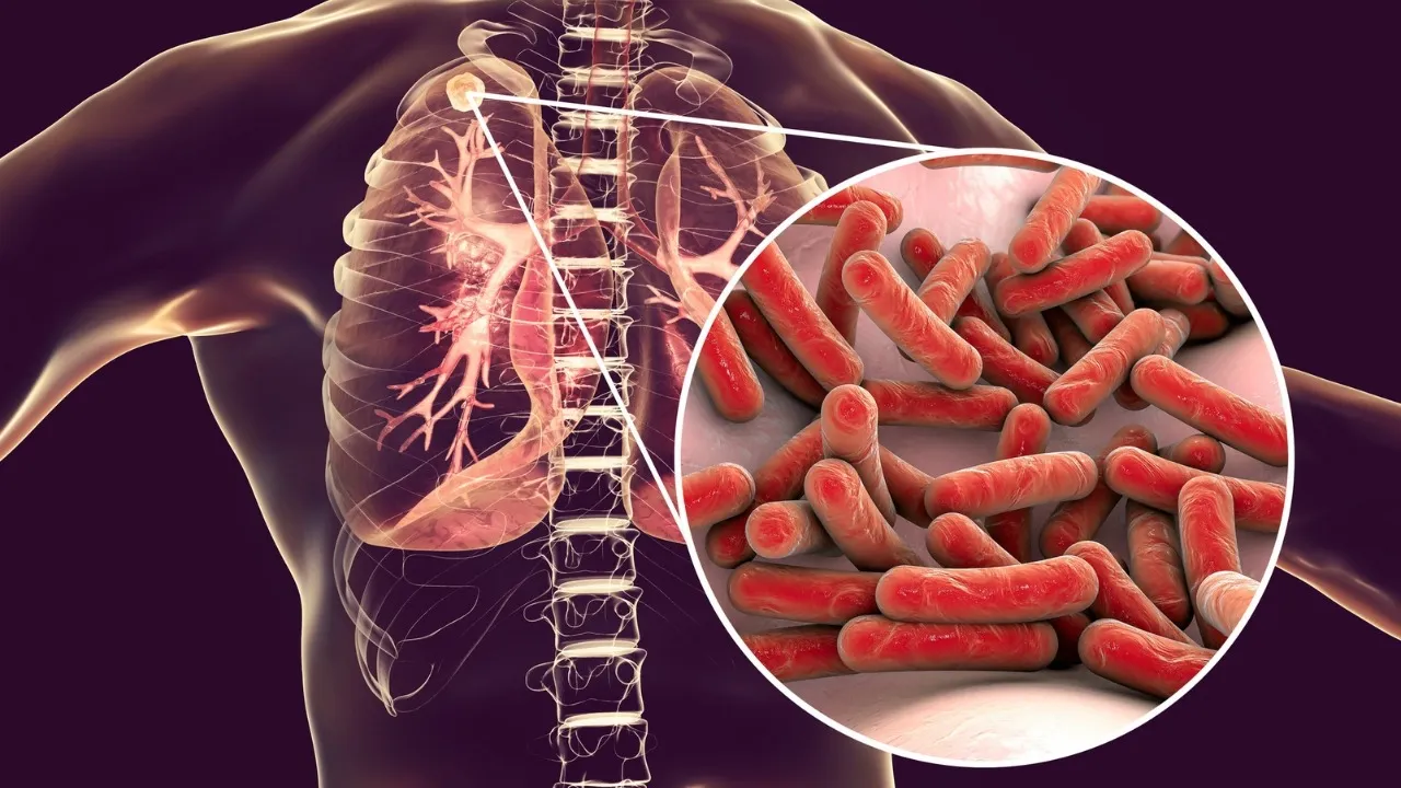 Made-in-India TB diagnostic tests validated by ICMR