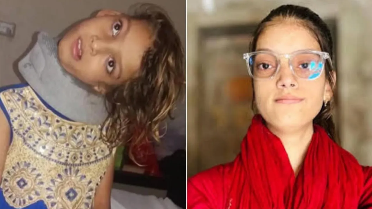 Indian doctors perform free life-saving surgery on Pakistani teen, netizens praise ‘Medical miracle beyond borders’