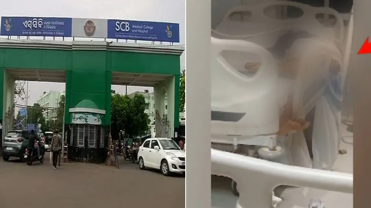 Patient falls off bed in SCBMCH ICU