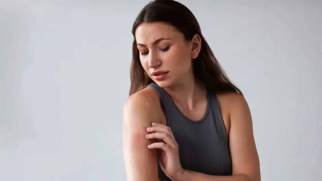 Get rid of bed bugs