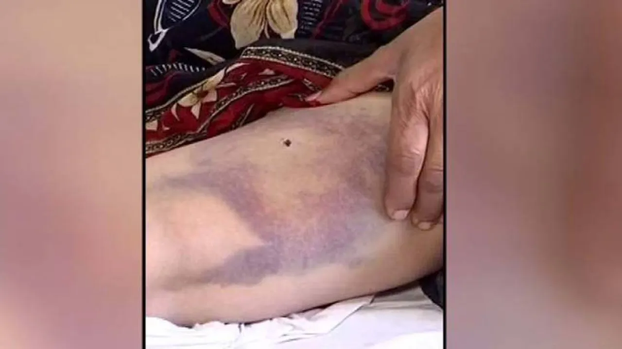 Woman Beaten Black & Blue, Paraded Naked Over Suspected Witchcraft