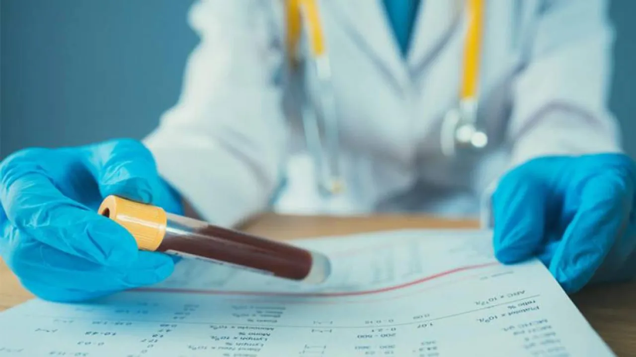 Blood Test Can Identify People At Risk Of Night-Time High BP