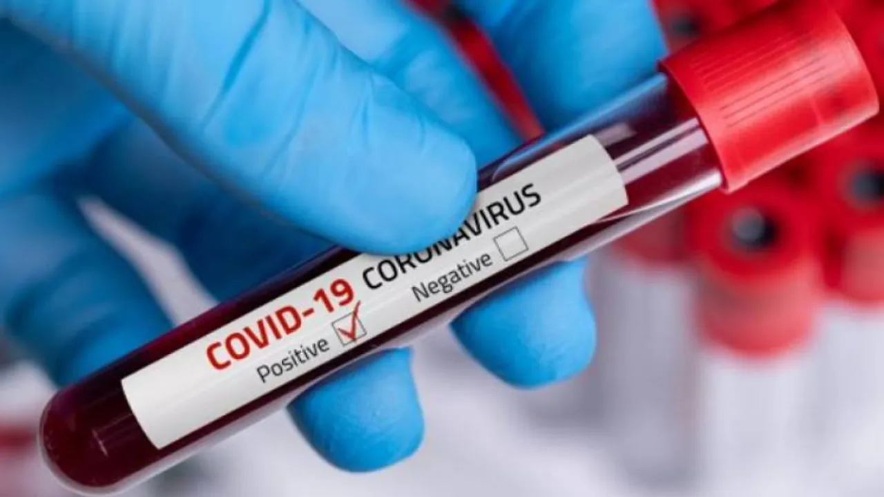 India Records 16,488 New COVID-19 Cases, 113 Deaths