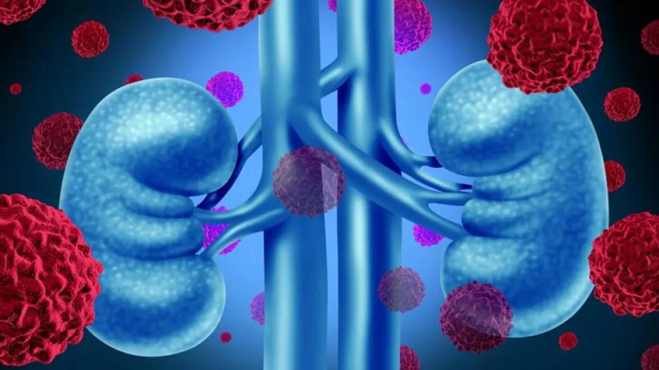 Kidney Disease Leading Risk Factor For Covid Hospitalisation Reveals Study