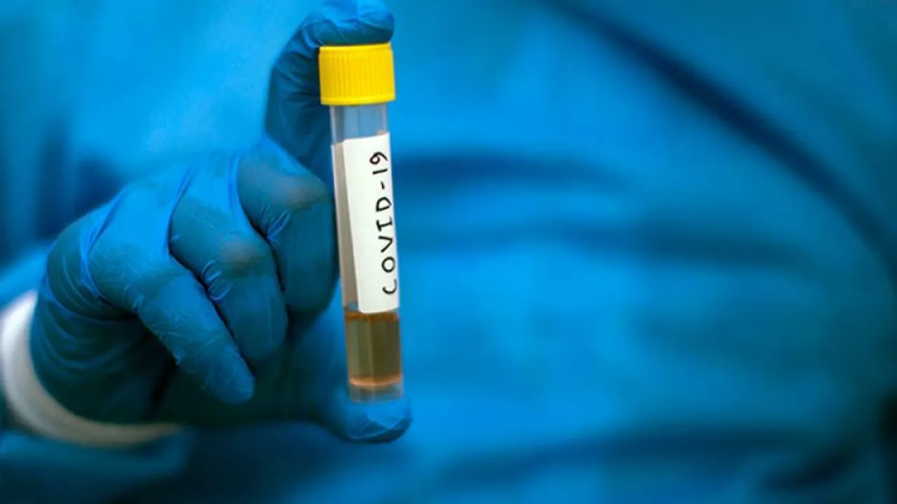 Nearly 15K New Covid Cases In India, Deaths Cross 14K-Mark