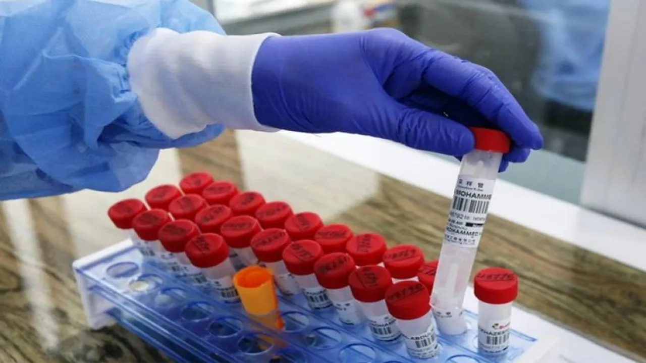 COVID-19: India Registers 30254 New Cases, 391 Deaths In Past 24 Hours