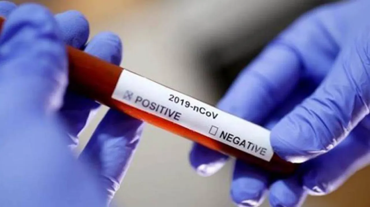 India Records 53,480 New COVID-19 Cases, 354 Deaths