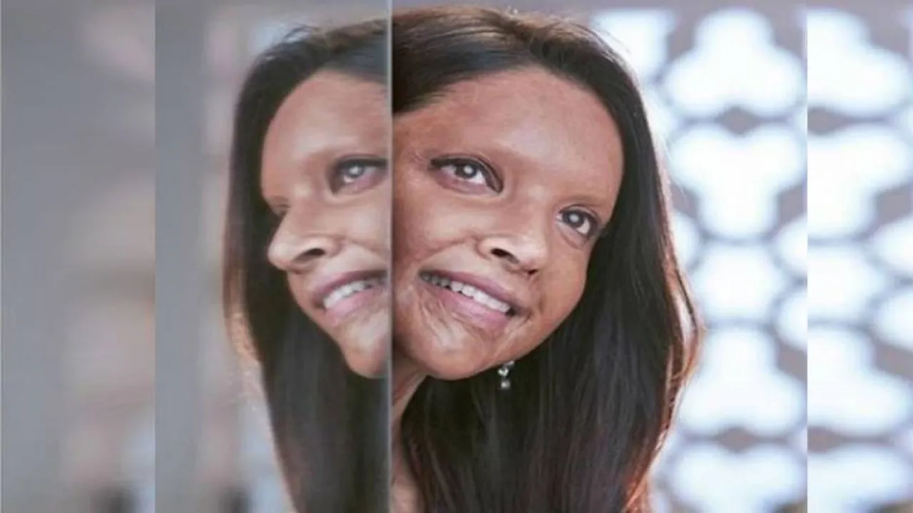 'Chhapaak' Review: Hard Truth Told The Hard Way