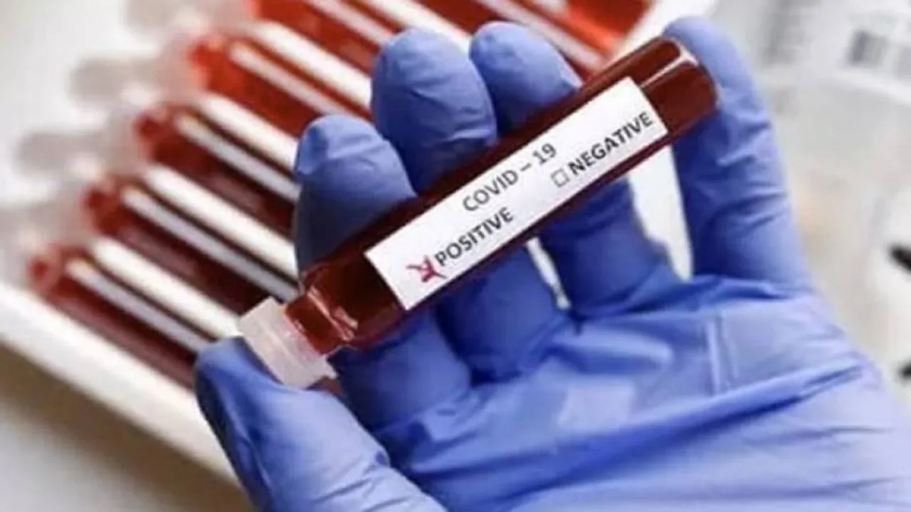 Corona patient with HIV recovers in 6 days In Lucknow