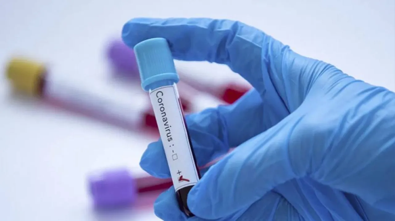 COVID19: India Records Highest Ever Single-day Spike Of 24,879 Cases, Tally Crosses 7.6 Lakh
