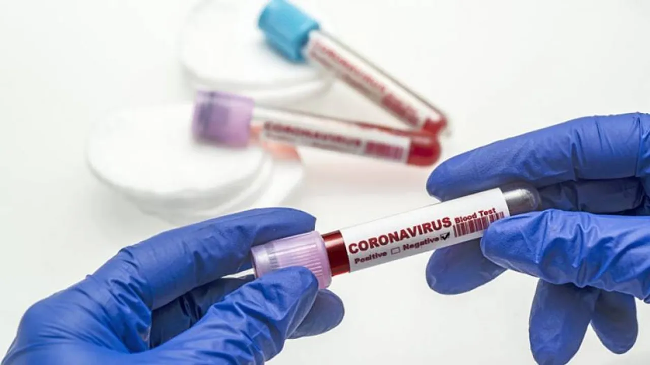 Highest Covid Deaths Of 3,780 In India, 3.82L Cases In 24 hrs