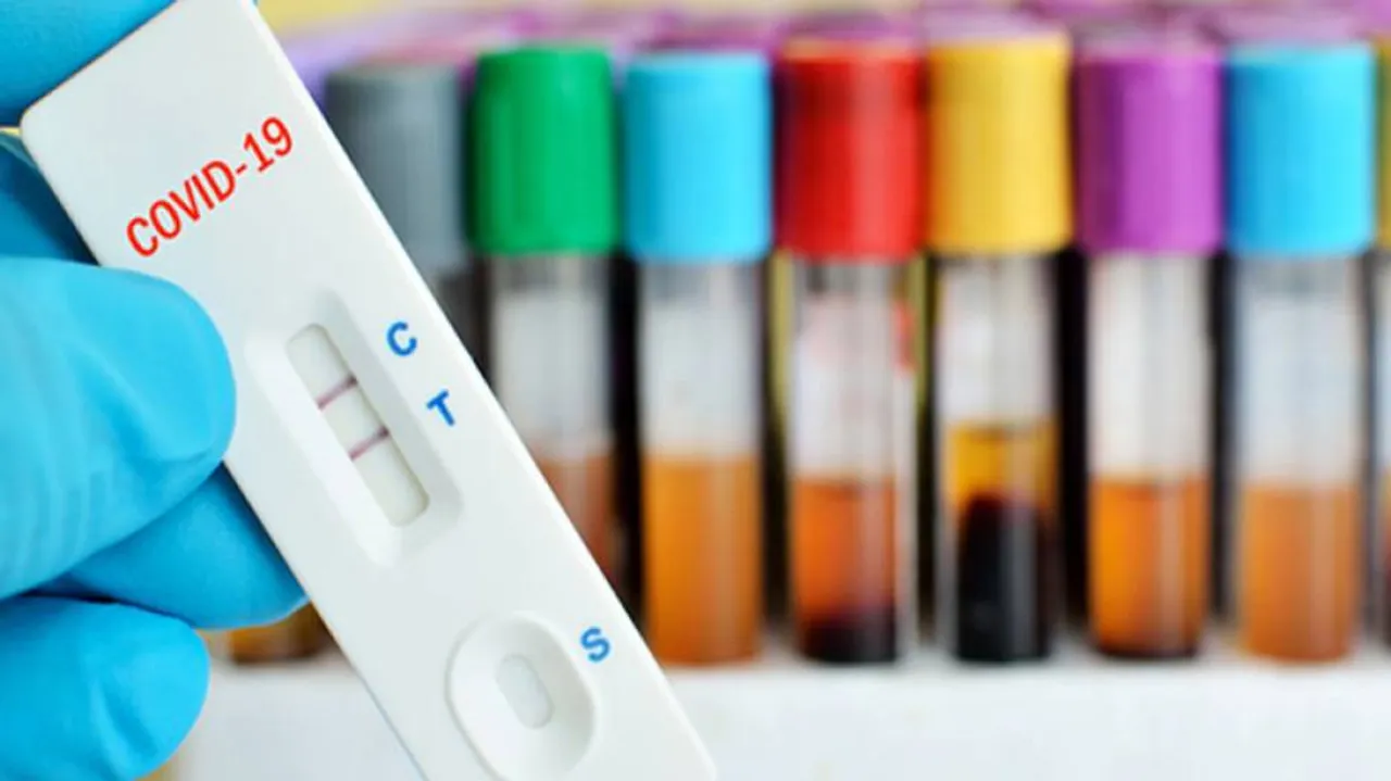 Researchers Develop Fast, Accurate, Low-Cost Diagnostic Test For Covid-19