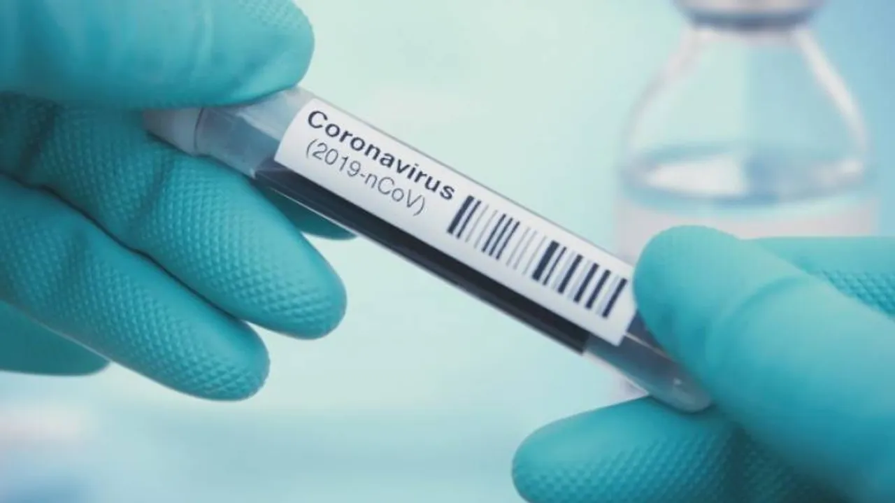 At 374, India Logs Lowest Covid Deaths In 125 Days