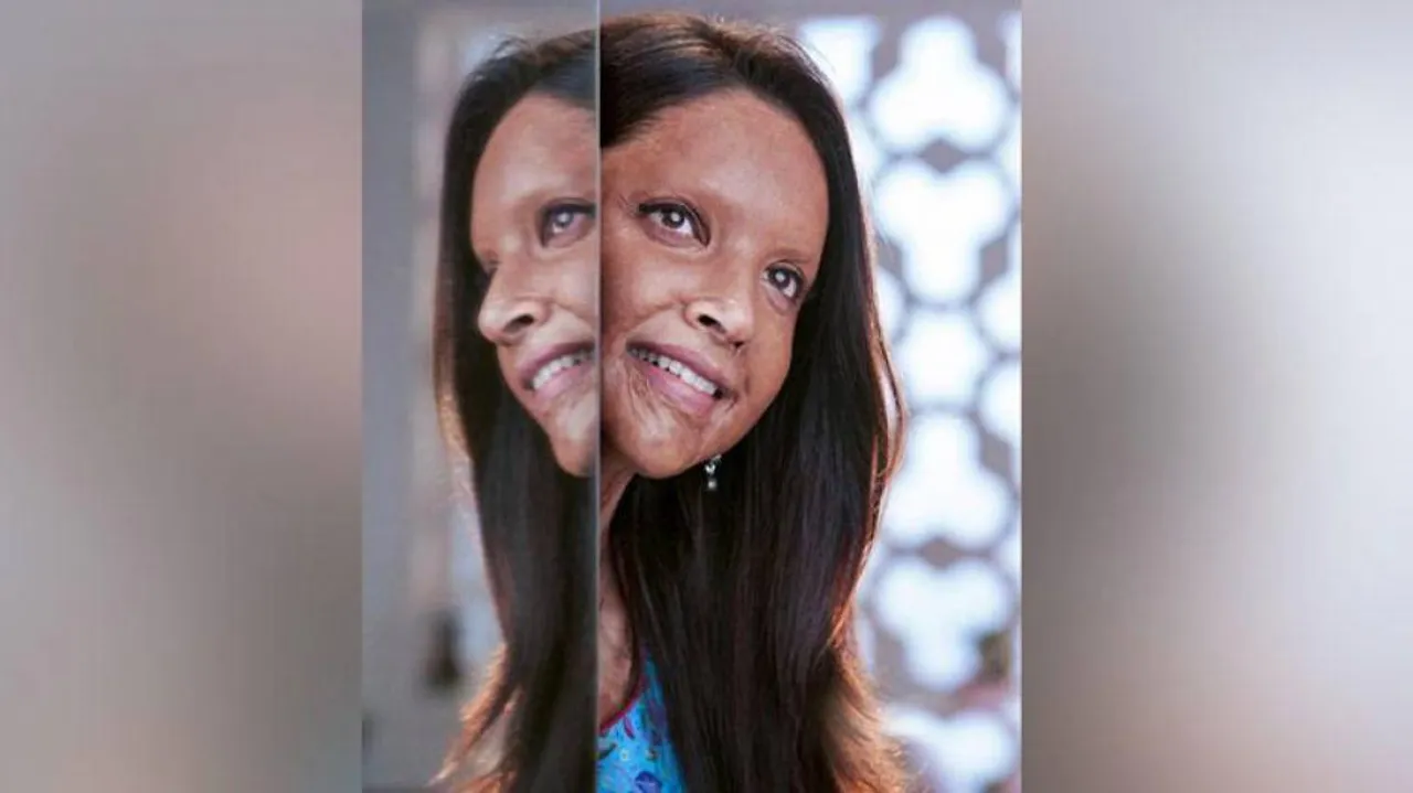 Deepika Padukone's acid attack survivor first look in Chhapaak out