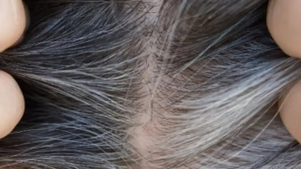 Grey Hair 