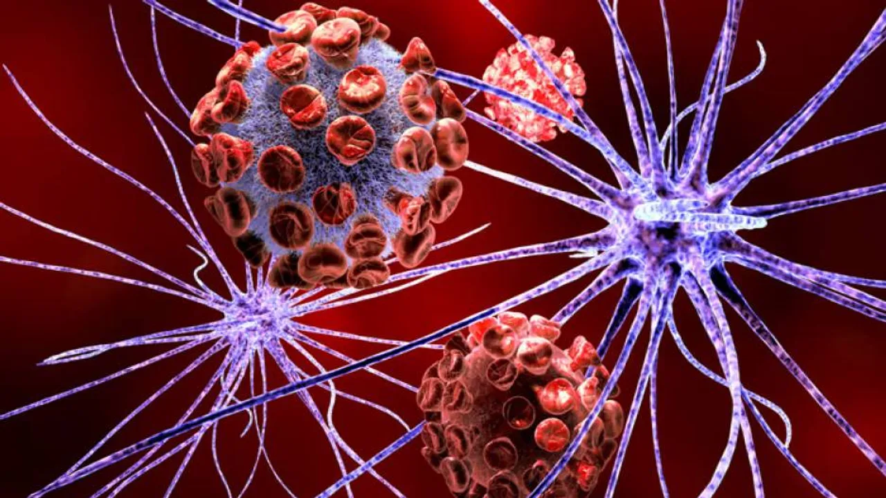 New blood test can predict onset of Huntington's disease