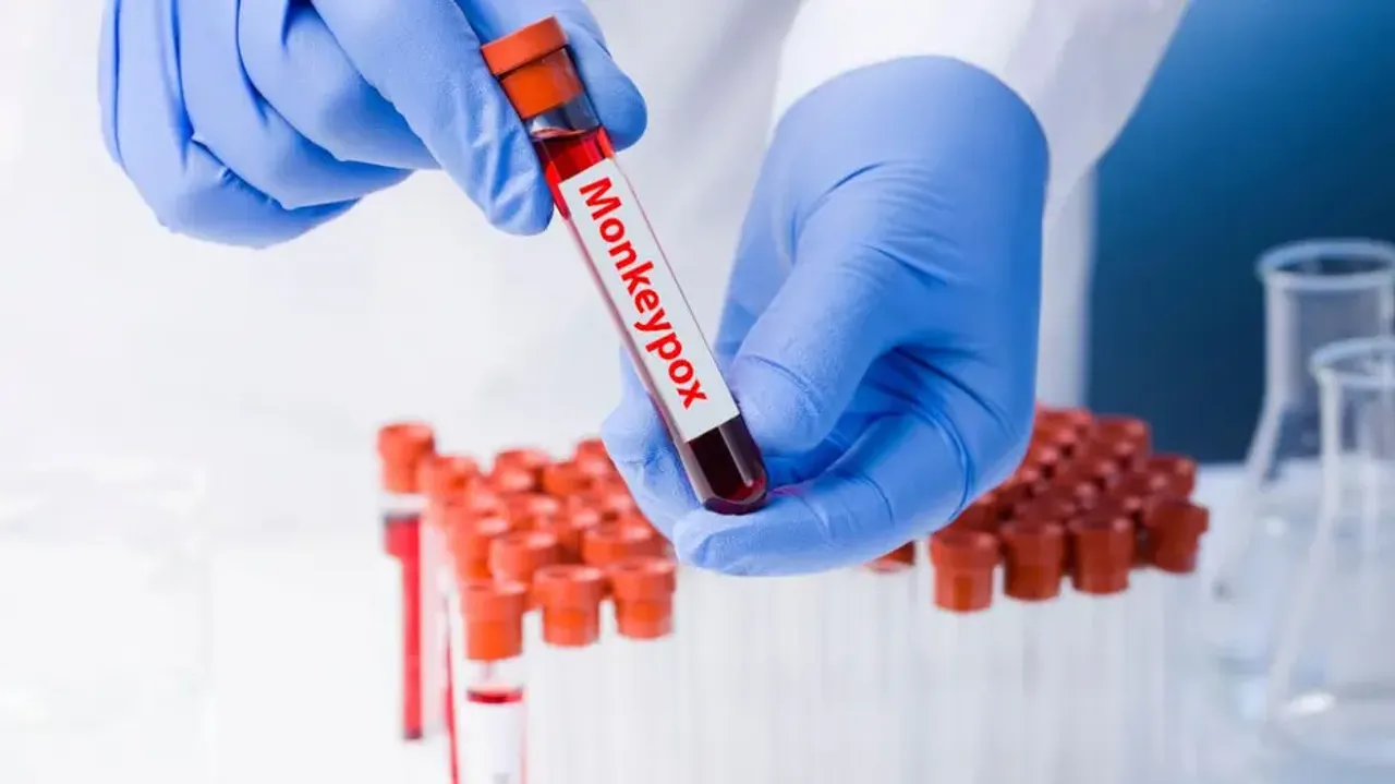 Suspected case of monkeypox in UP