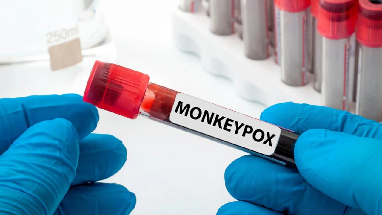 Monkeypox